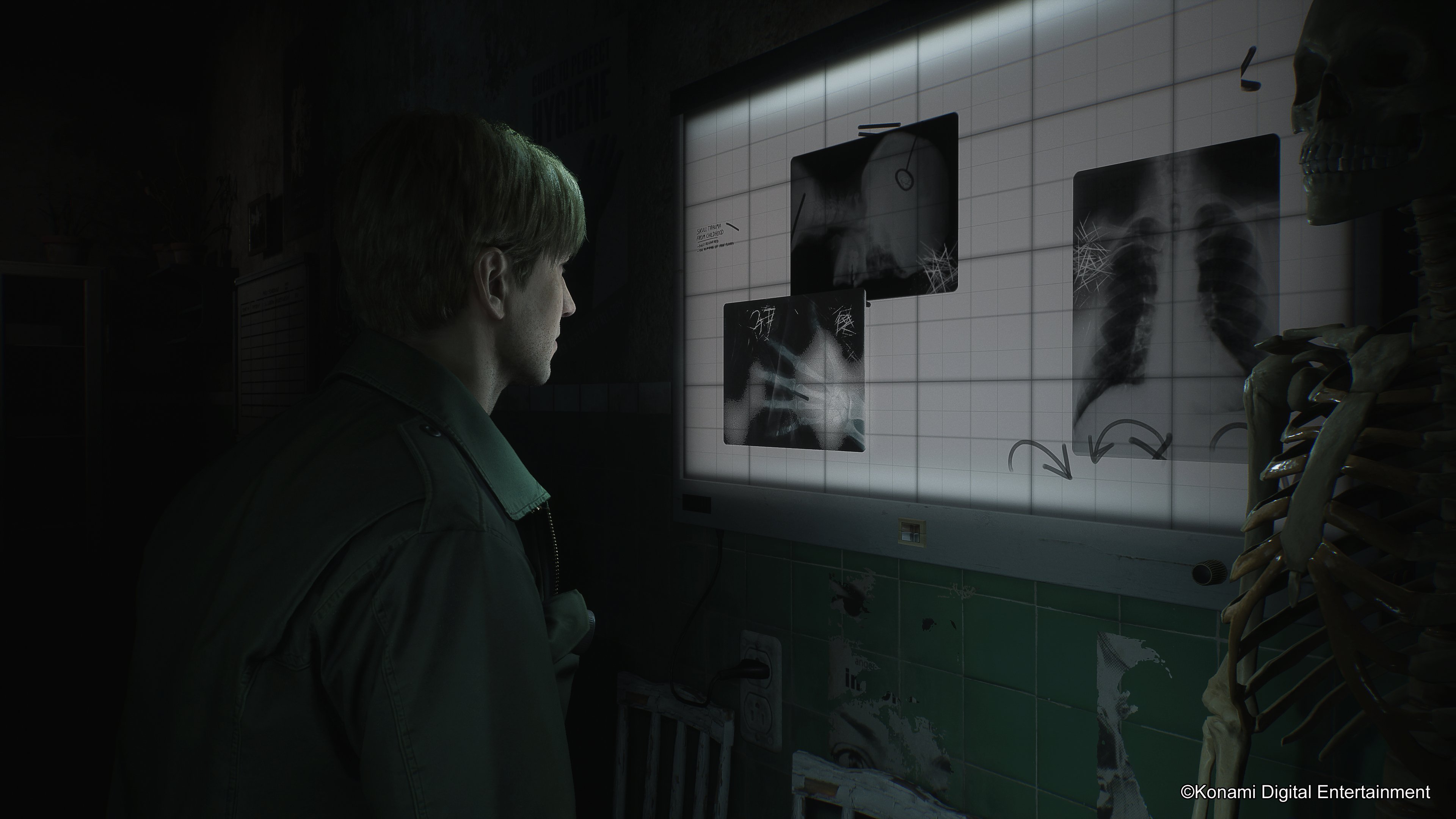 Silent-Hill-2_2024_05-30-24_009
